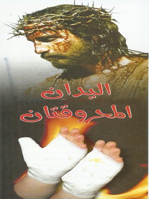 cover image of اليدان المحروقتان